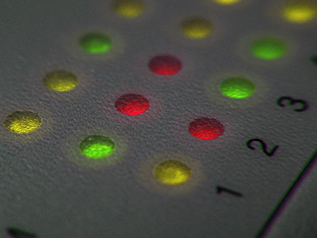 A Wanadoo újabb csatát indított a szélessáv előfizetőiért dúló brit háborúban