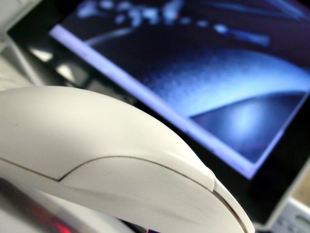 Egy év alatt 106%-kal gyarapodott a zeneletöltések piaca